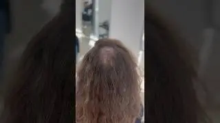 Выпадают волосы ? Не беда 😎Делаем короткую стрижку  #мужскаястрижка #menshair #алопеция #fade #