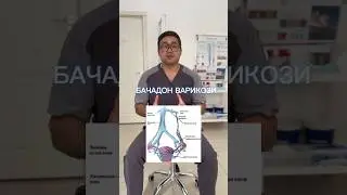 БАЧАДОН ВАРИКОЗИ 