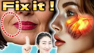 Gently Cup Your Cheek and See Nasolabial Folds Fade Away