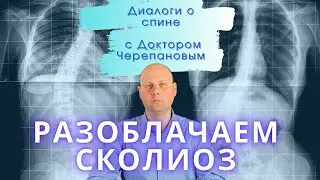 Сколиоз | Как отличить болезнь от плохой осанки? Как лечить сколиоз?