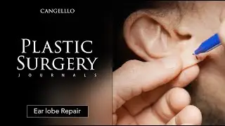 How Are Earlobe Repairs Done? | Plastic Surgery Journals | Cangello Plastic Surgery