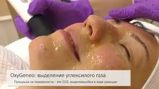 Процедура geneO+ основные этапы проведения процедуры