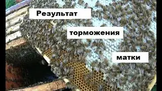 Результат торможения матки за 11 дней