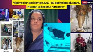 Victime d’un accident en 2017 :  89 opérations plus tard, Nusrath se bat pour remarcher
