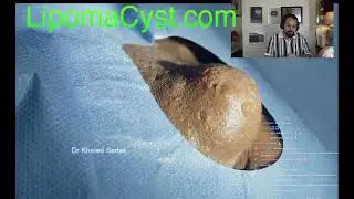 Dr Khaled Sadek Live Chat  3rd December  2023.