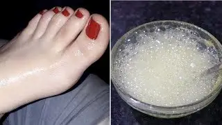 Foot Whitening Bleach|सालों साल जमी मैल व गंदगी मिनटों में साफ करें|How to get fair foot at home|
