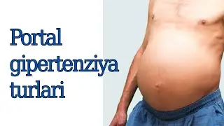 Portal gipertenziya turlari. 4 kurs talabasi Abdumannonov Ziyodullo