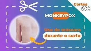 Monkeypox - Uso de máscara durante o surto da doença