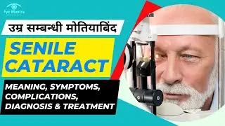 उम्र सम्बन्धी मोतियाबिंद (Senile Cataract): Symptoms &Treatment
