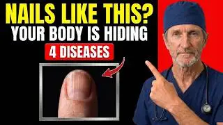 If Your Nails Look Like THIS After 65, Your Body May Be Hiding 4 Diseases!
