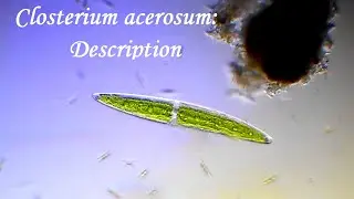 Closterium acerosum: Discription