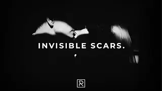 [FREE] 6lack Type Beat INVISIBLE SCARS. Sad Emotional Trap Beat