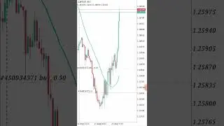 Forex trading 🔴$100🔴 live today