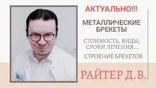 Металлические брекеты | Стоимость металлических брекетов | Поставить брекеты | Отзывы и фиксация