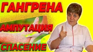 💊 Гангрена ноги 🔴 Спасение от ампутации 🔴 Гангрена при сахарном диабете ✅ профилактика ✅ лечение