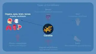 Overcoming Challenges in the Diagnosis and Treatment of Invasive Fungal Infections