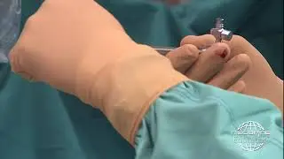 RIWOspine full-endoscopic Spine Surgery - transforaminal approach
