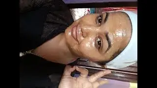 राती यी २ चिज लगाउनुश जस्तोसुकै चाउरी परेको छाला पनि १ हप्तामै जवान हुनेछ ।सुख्खा स्किन नरम बनाउनेछ
