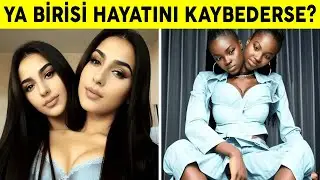 Milyarda Bir Dünyaya Gelen Yapışık İkizlerin Sıradışı Dünyaları! Mucize Vakalar