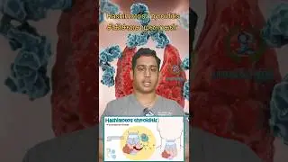 Hashimoto's Thyroiditis சிகிச்சை முறைகள்|Hashimoto's disease treatment #hashimoto #thyroiditis