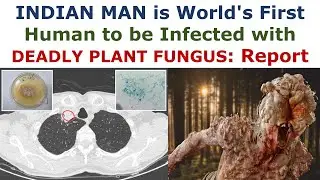 Indian man is world's first human to be infected with de**dly plant fungus: report