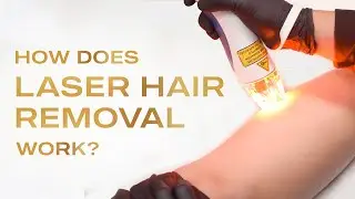 Laser Hair Removal Explained!