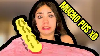HAGO UN GRANO Y LO EXPLOTO XDDD