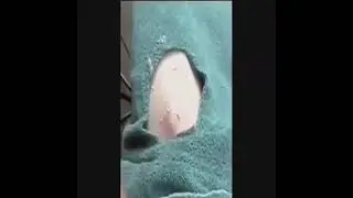 Olha essas ESPINHAS GIGANTES! 😱😱😱 - satisfatório