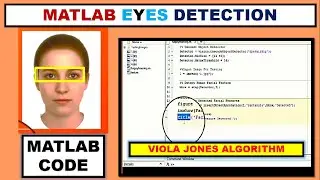Simple Matlab Code for Eyes Detection ~xRay Pixy