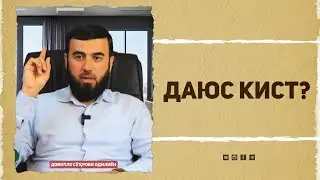 Даюс кист?