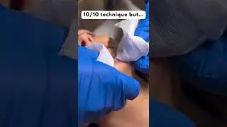 Huge pimple sqiorts everywhere