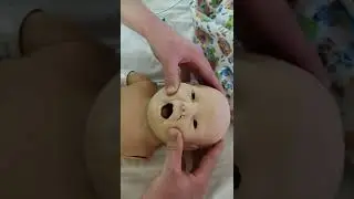 Метод Кастильо Моралес 1 этап