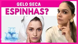 ACNE E GELO: REVELAMOS A VERDADE POR TRÁS DESTE REMÉDIO CASEIRO
