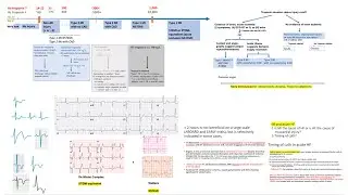 NSTEMI