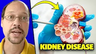 Recruitment For Natural Kidney Disease Study - Sign Up Kidney Patients!