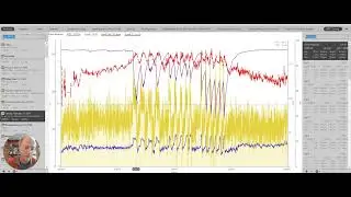 Understanding Dynamic Functional Reserve Capacity By Hunter Allen