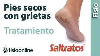 Pies secos y con grietas. Qué es, causas, consejos y tratamiento