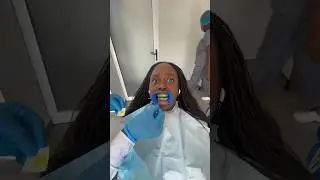 Finally getting my teeth whitened 🦷 #dentist #teeth #whitening