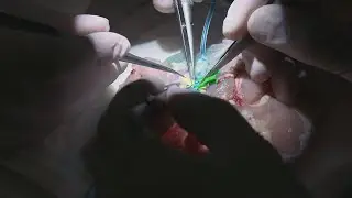 How chicken thighs help train Wisconsin surgeons: LiveBIG 2019-20