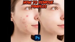 How to remove pimples with Photoshop