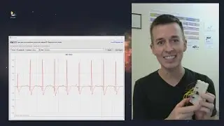 DIY ECG - 1 op-amp version