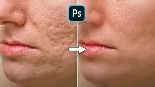 How To Fix Acne Scars or Wrinkles Fast | Photoshop Tutorial