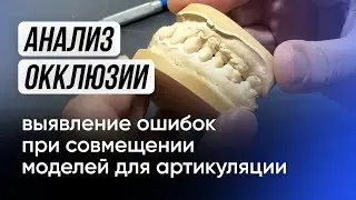 Анализ окклюзии, выявление ошибок при совмещении моделей для артикуляции