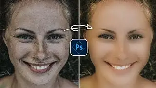 Skincare Photoshop
