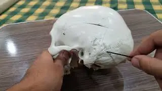 skull osteolgy |Norma laterals |norma verticals |norma occipitals | part 2