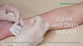 First Aid: Cuts & Bruises