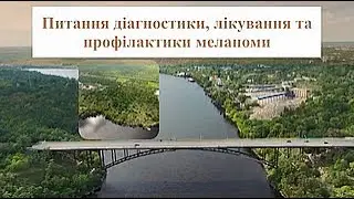 Питання діагностики, лікування та профілактики меланоми              Сергій Пащенко