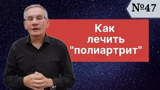 Как лечить полиартрит? Выпуск №47