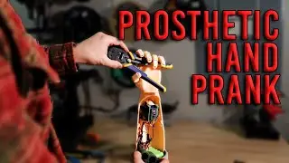 Making a Prosthetic Hand as a Prank