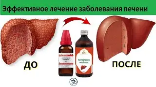 Эффективное лечение заболевания печени